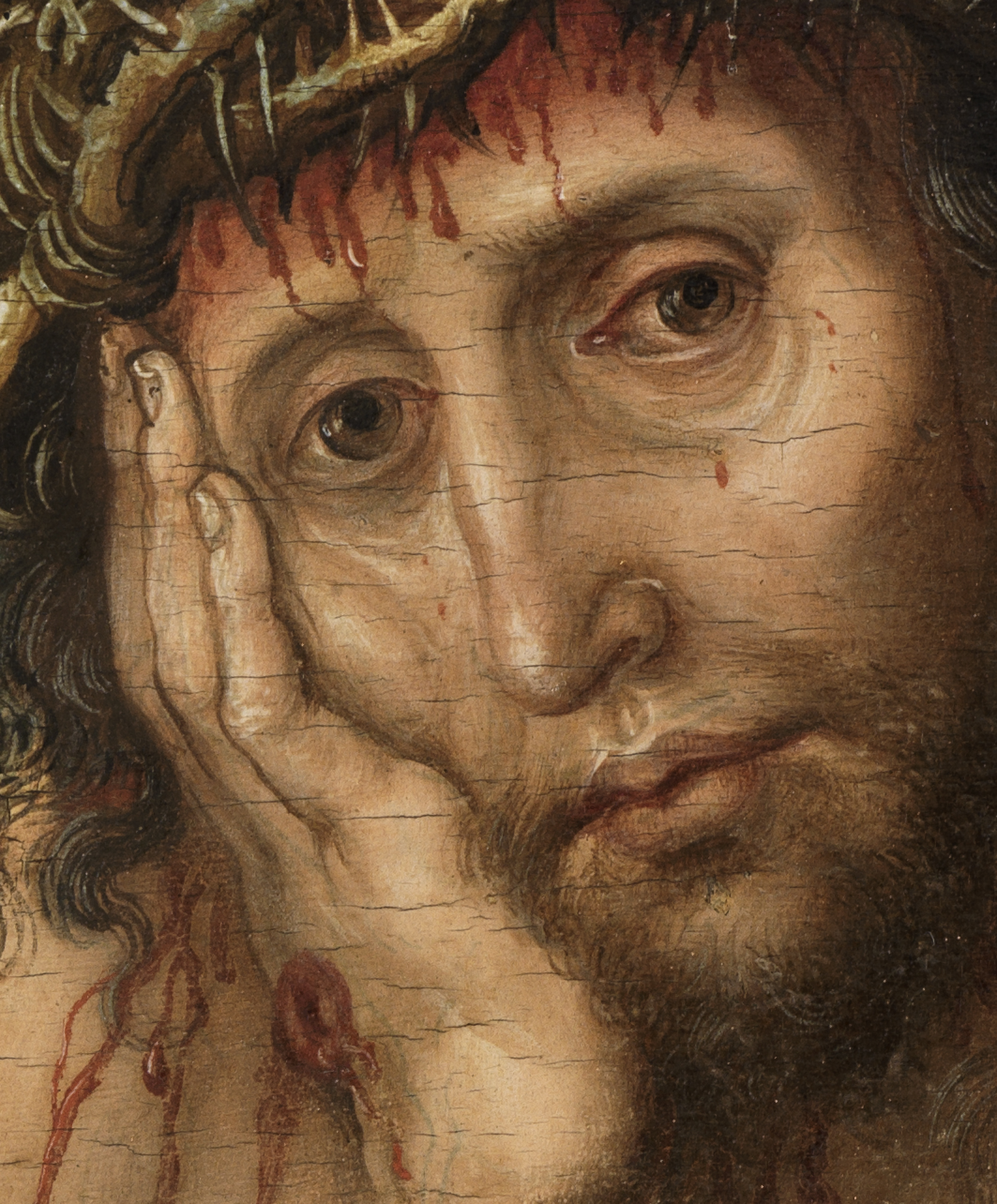 Albrecht Dürers Schmerzensmann. Detail: Gesicht Christi, blutüberströmt, in die Hand gestützt. Christus schaut den Betrachter direkt an.